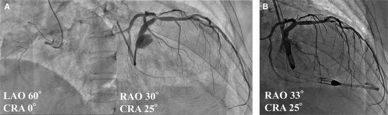 Figure 4