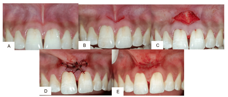 Figure 2