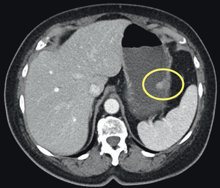 Fig. 1
