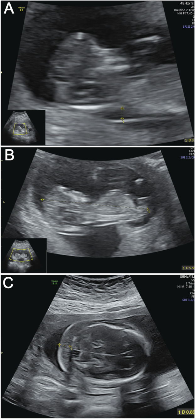 FIGURE 1