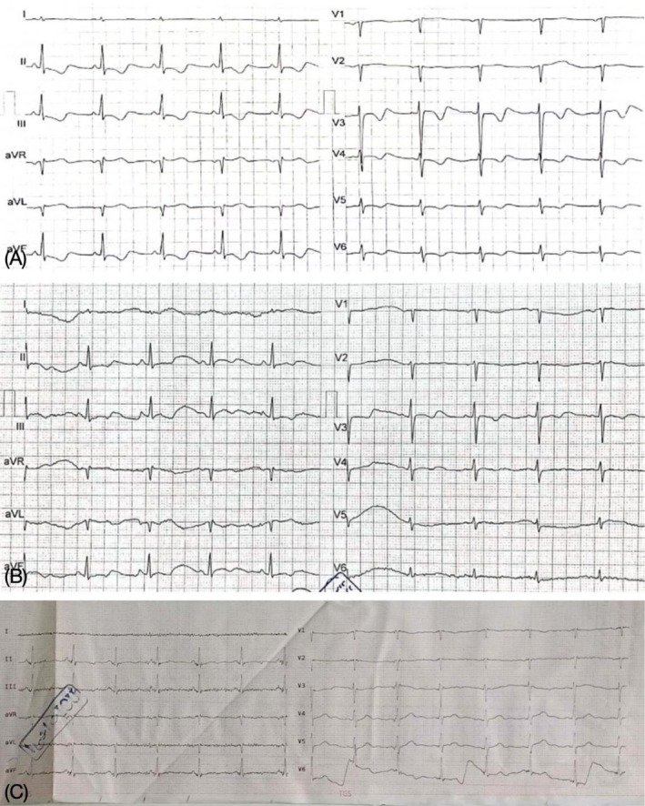 FIGURE 2