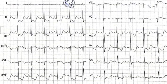 FIGURE 1
