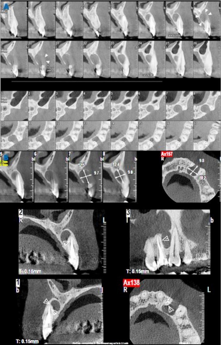 FIGURE 3