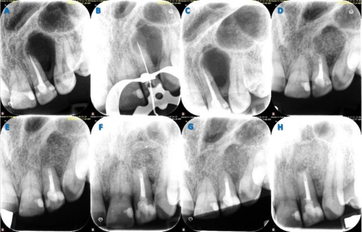 FIGURE 2