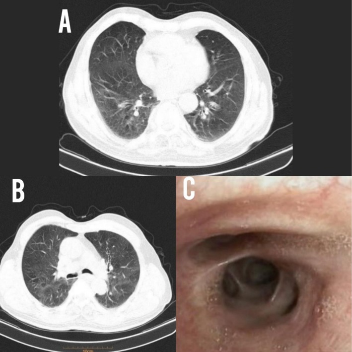 FIGURE 1