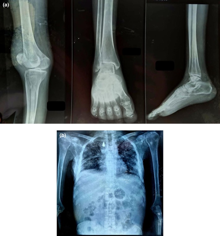 FIGURE 2