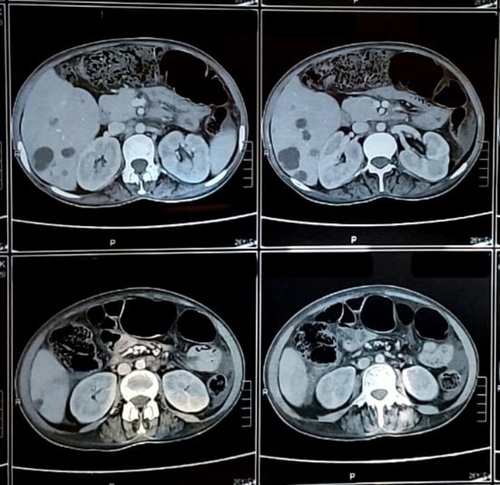 FIGURE 3