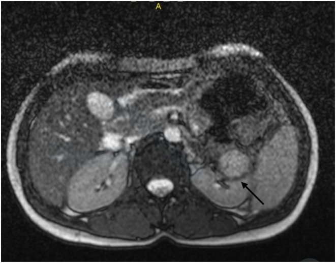 FIGURE 3