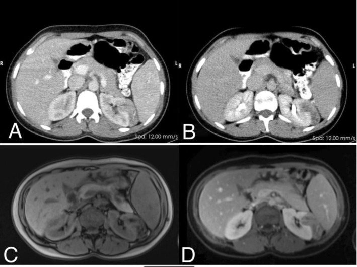 FIGURE 1