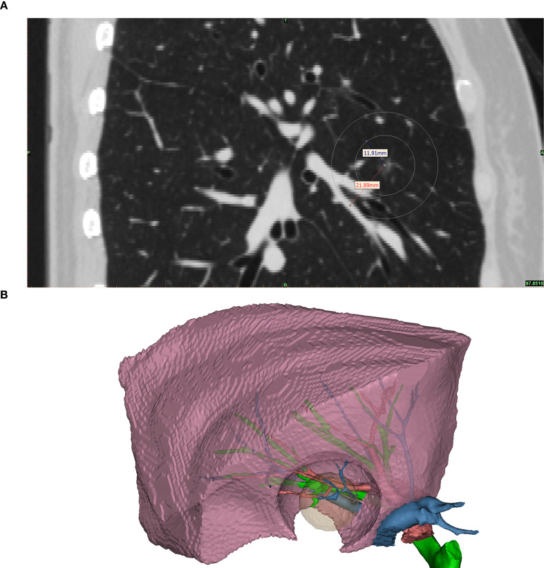 Figure 1