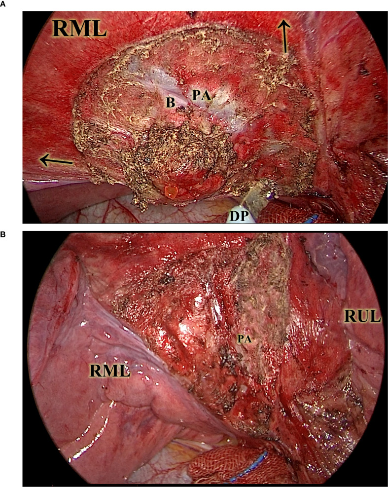 Figure 3