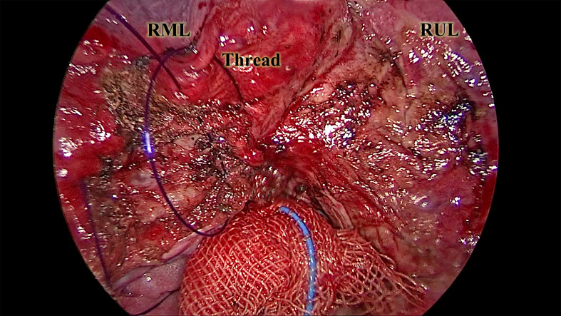 Figure 4