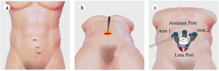 Figure 2
