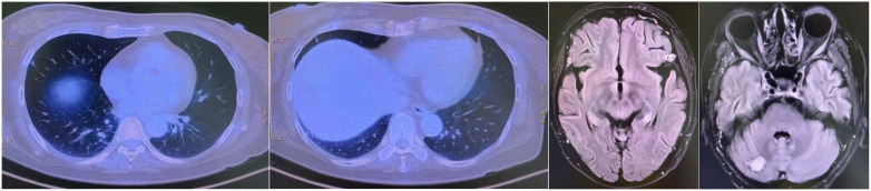 Figure 4