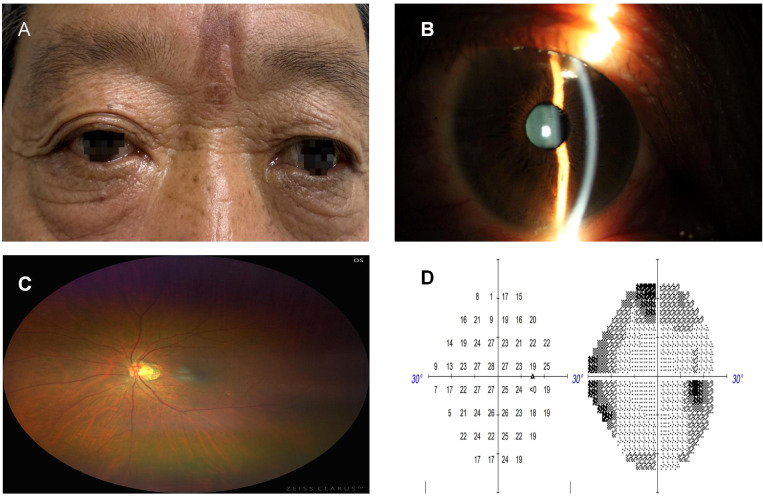 Figure 1