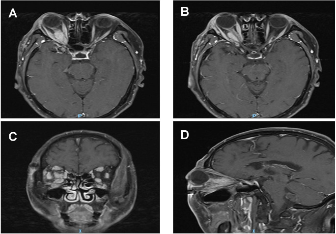 Figure 2