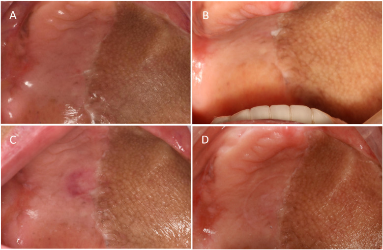 Figure 10