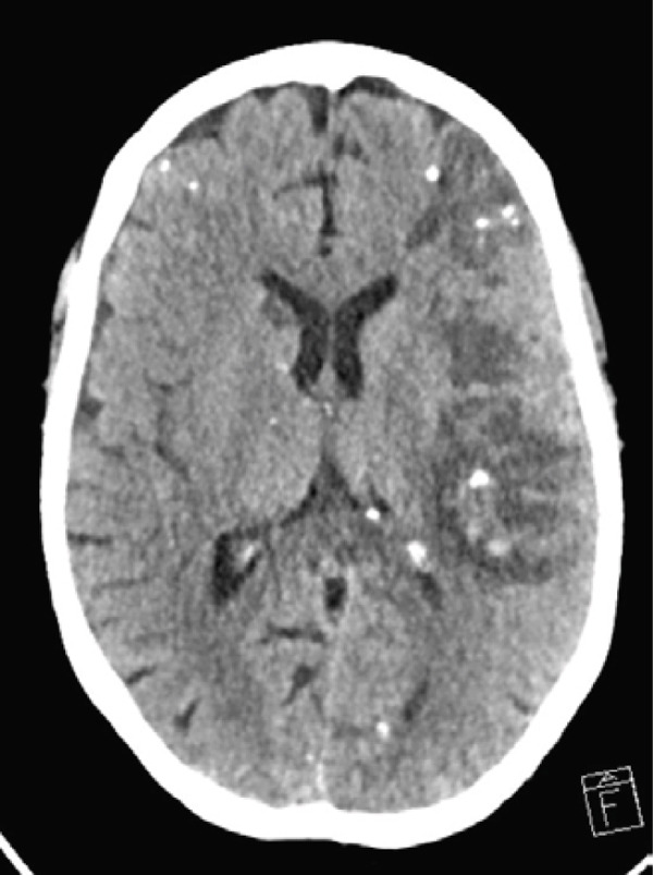 Figure 12