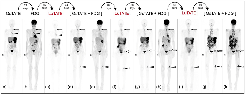 Fig. 4