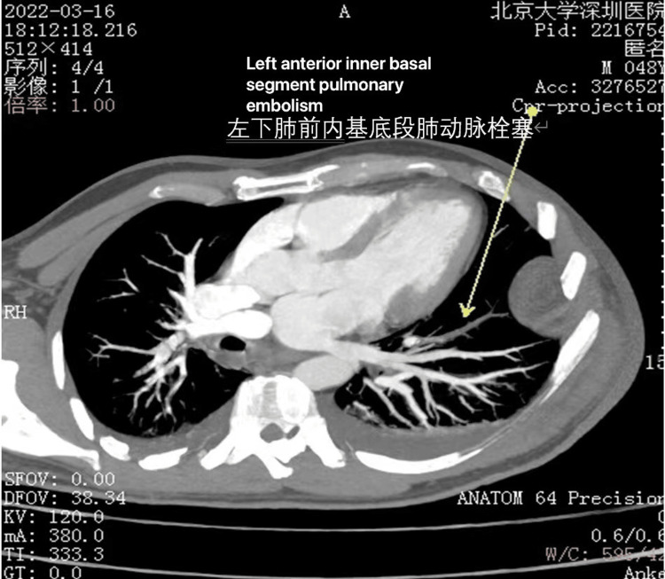 Figure 6