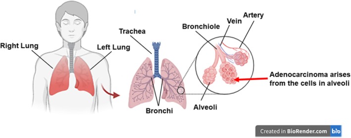FIGURE 1