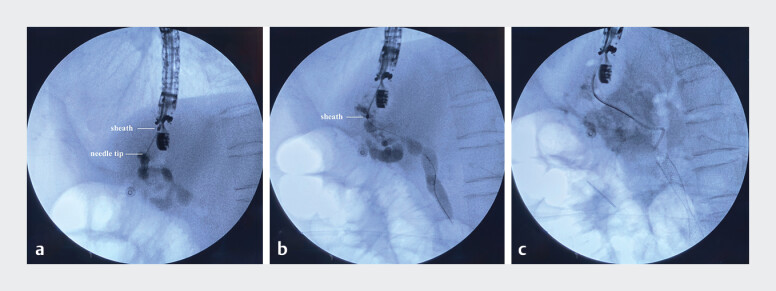 Fig. 3