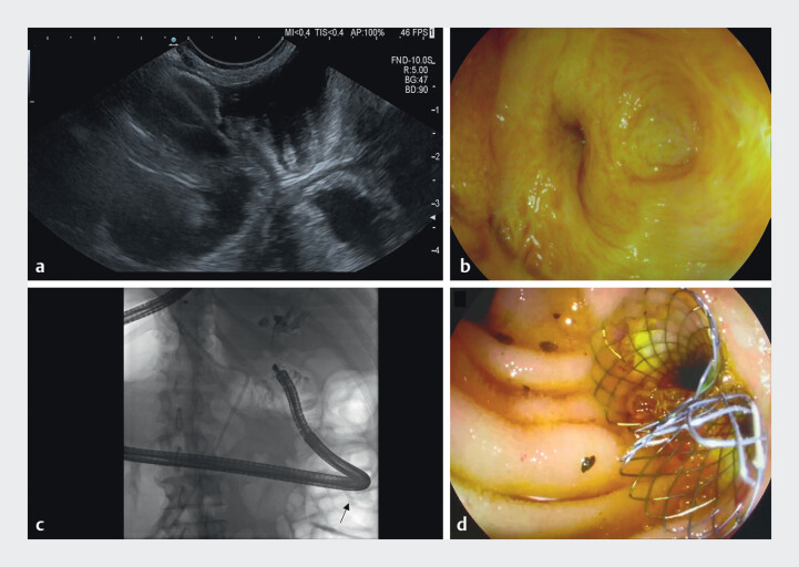 Fig. 2