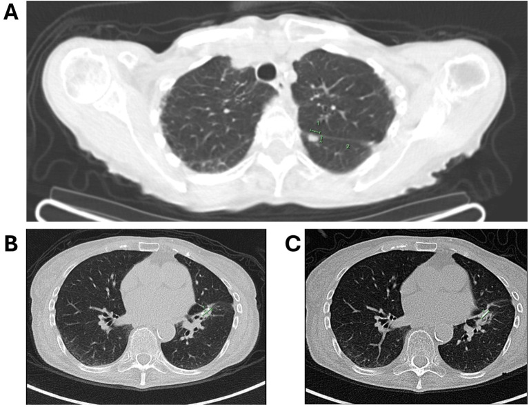 Figure 2