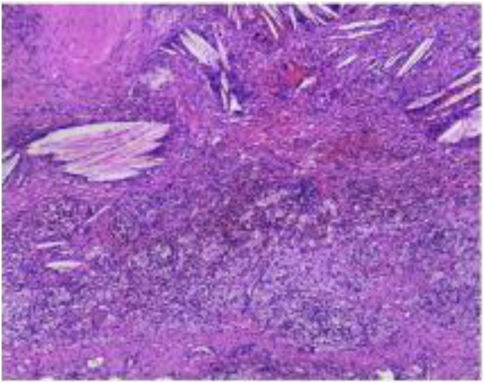 Figure 3
