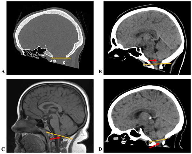 Figure 1