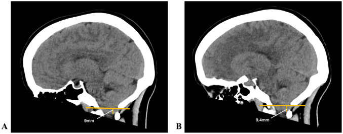 Figure 3