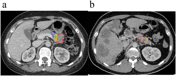 Figure 1