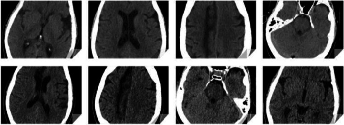 FIGURE 3