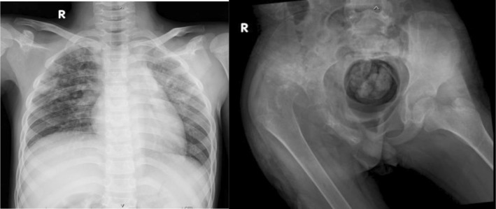 FIGURE 2
