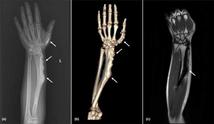 FIGURE 1