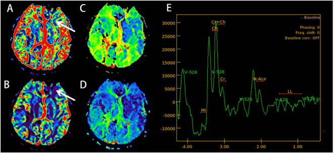 Figure 2