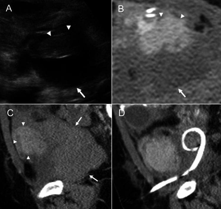 Figure 13