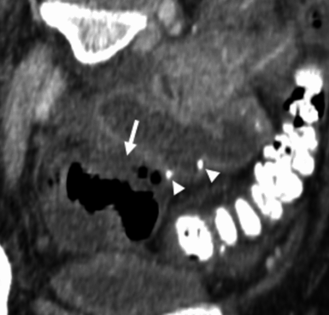 Figure 14