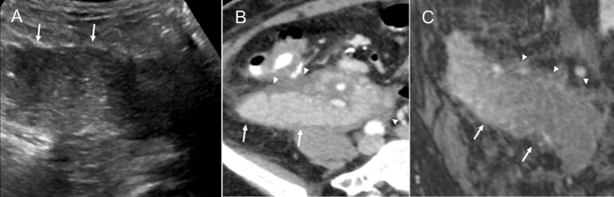 Figure 16