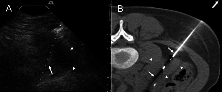 Figure 17