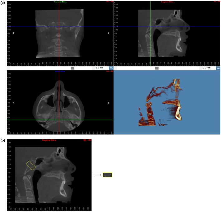 FIGURE 1