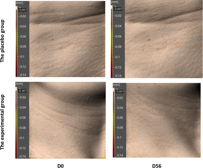 FIGURE 7