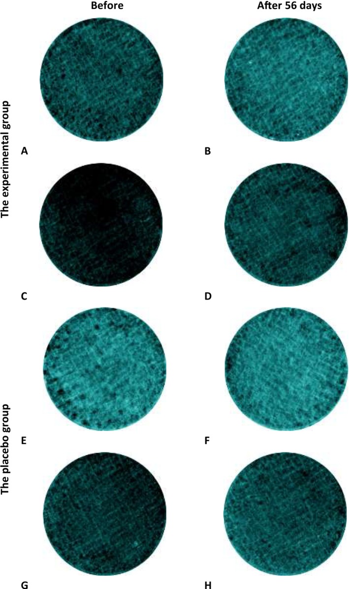 FIGURE 3