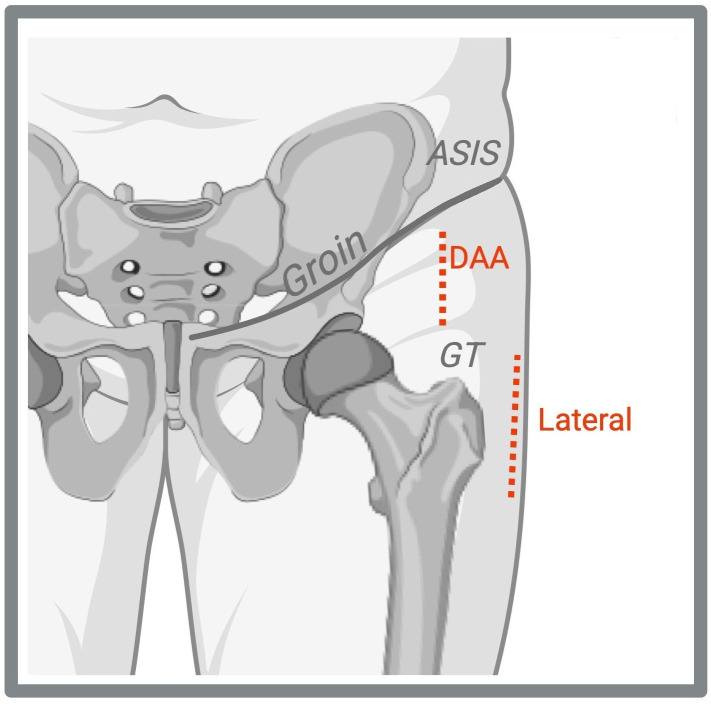 Figure 1