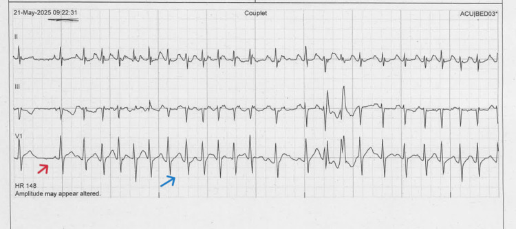Figure 5