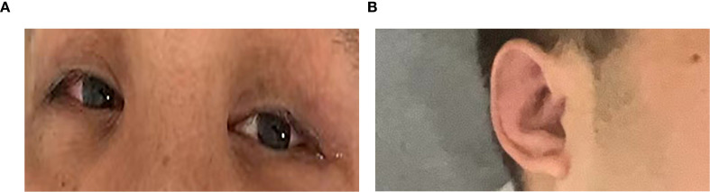 Figure 1