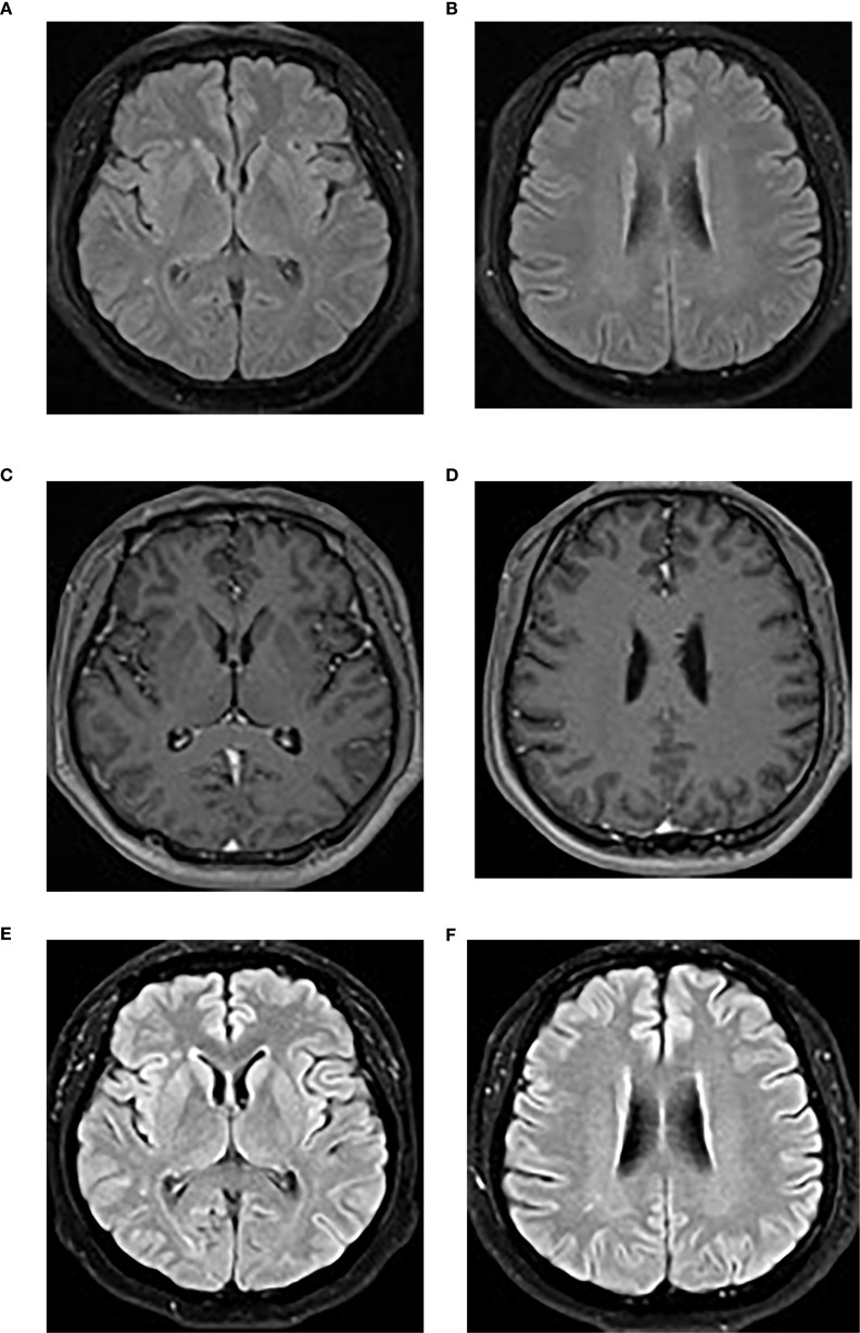 Figure 3