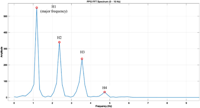 FIGURE 4