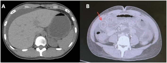 Figure 2