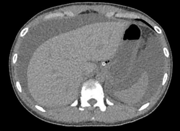 Figure 3